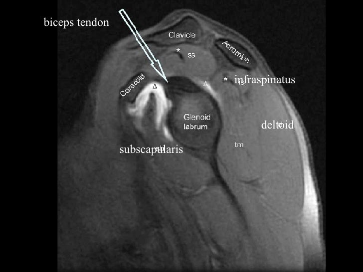 MRI slides, second yr students 2008