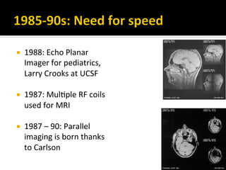 Historical Mri Machine MRI: A historical perspective | PDF