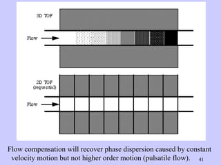 Flow compensation will recover phase dispersion caused by constant velocity motion but not higher order motion (pulsatile flow). 
