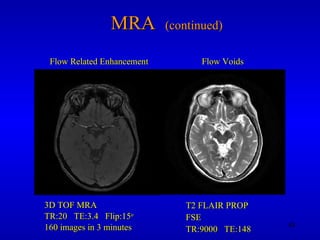 MRA  (continued) 3D TOF MRA TR:20  TE:3.4  Flip:15 o 160 images in 3 minutes T2 FLAIR PROP FSE TR:9000  TE:148 Flow Related Enhancement Flow Voids 