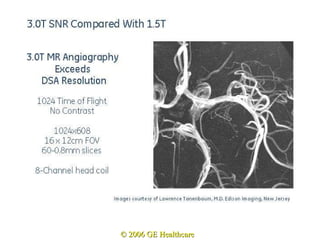 © 2006 GE Healthcare 