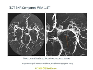 © 2006 GE Healthcare 