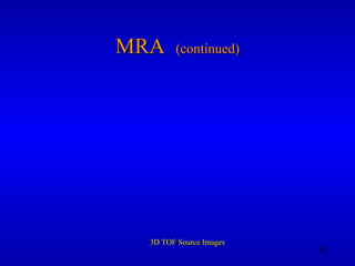 MRA  (continued) 3D TOF Source Images 