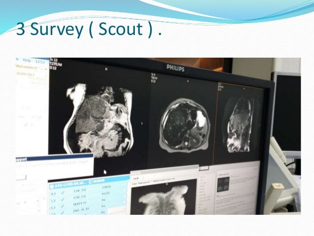 Mri Abdomen Dynamic Study Tri Phasic Of Liver - 1 axial !   t2 t1 t2 heavy