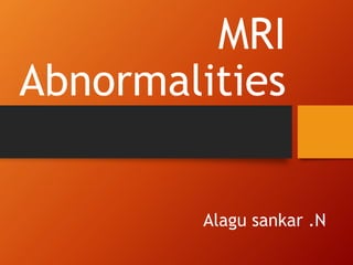 Alagu sankar .N
MRI
Abnormalities
 