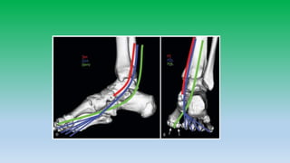 Mri anatomy of ankle radiology ppt pk