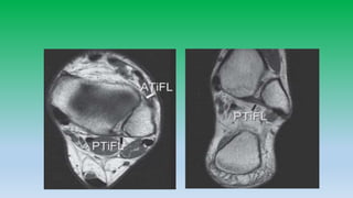 Mri anatomy of ankle radiology ppt pk