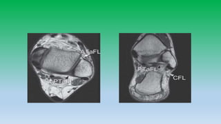 Mri anatomy of ankle radiology ppt pk