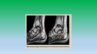 Mri anatomy of ankle radiology ppt pk