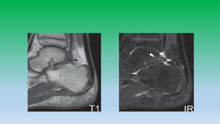 Mri anatomy of ankle radiology ppt pk