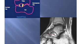 Mri anatomy of ankle radiology ppt pk