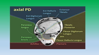 Mri anatomy of ankle radiology ppt pk