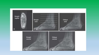 Mri anatomy of ankle radiology ppt pk
