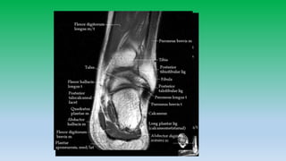 Mri anatomy of ankle radiology ppt pk