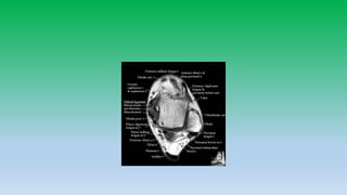 Mri anatomy of ankle radiology ppt pk
