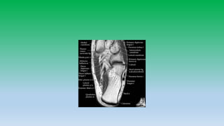 Mri anatomy of ankle radiology ppt pk