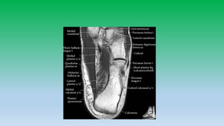 Mri anatomy of ankle radiology ppt pk