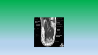 Mri anatomy of ankle radiology ppt pk