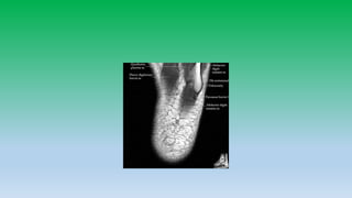 Mri anatomy of ankle radiology ppt pk
