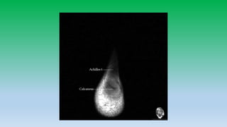 Mri anatomy of ankle radiology ppt pk