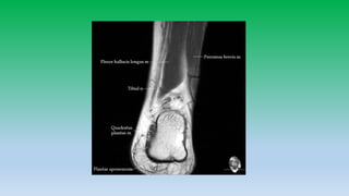 Mri anatomy of ankle radiology ppt pk