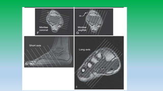 Mri anatomy of ankle radiology ppt pk