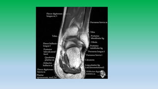 Mri anatomy of ankle radiology ppt pk