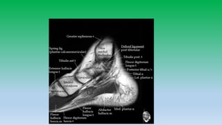 Mri anatomy of ankle radiology ppt pk