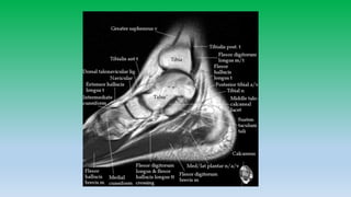 Mri anatomy of ankle radiology ppt pk