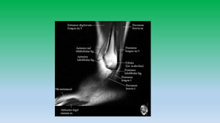 Mri anatomy of ankle radiology ppt pk