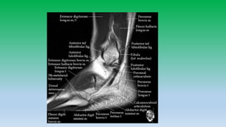 Mri anatomy of ankle radiology ppt pk