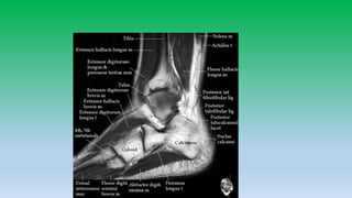 Mri anatomy of ankle radiology ppt pk