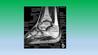 Mri anatomy of ankle radiology ppt pk