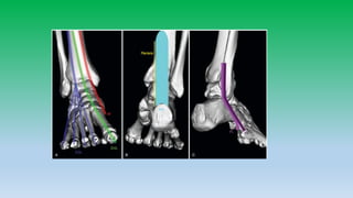 Mri anatomy of ankle radiology ppt pk