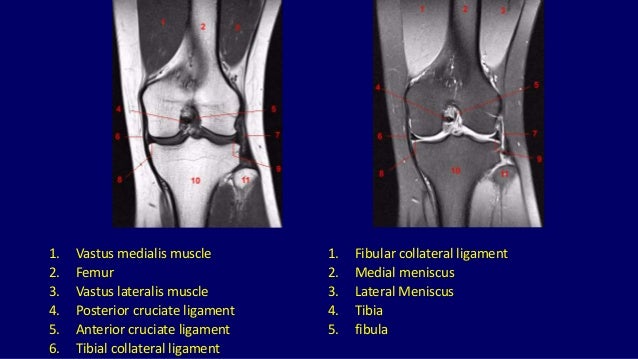 Mri anatomy of knee Dr. Muhammad Bin Zulfiqar