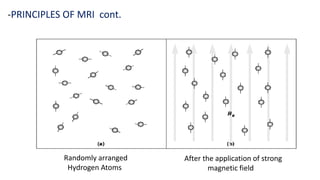 Randomly arranged
Hydrogen Atoms
-PRINCIPLES OF MRI cont.
After the application of strong
magnetic field
 