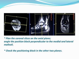 * Plan the coronal slices on the axial plane;
angle the position block perpendicular to the medial and lateral
malleoli.
* Check the positioning block in the other two planes.
 