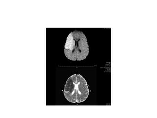 MRI APPLICATION CLINICAL PRACTICE.pptx RADIOLOGY | PPTX