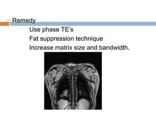  Remedy
Use phase TE’s
Fat suppression technique
Increase matrix size and bandwidth.
 
