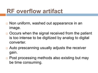 RF overflow artifact
 Non uniform, washed out appearance in an
image.
 Occurs when the signal received from the patient
is too intense to be digitized by analog to digital
converter.
 Auto prescanning usually adjusts the receiver
gain.
 Post processing methods also existing but may
be time consuming.
 