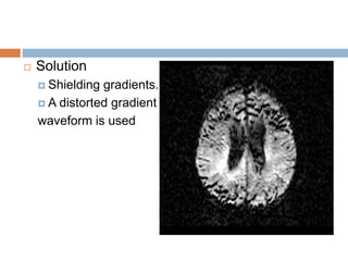  Solution
 Shielding gradients.
 A distorted gradient
waveform is used
 