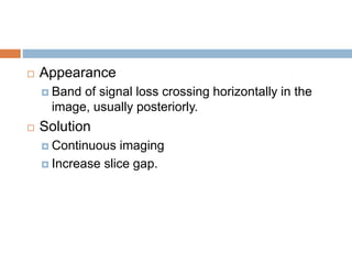  Appearance
 Band of signal loss crossing horizontally in the
image, usually posteriorly.
 Solution
 Continuous imaging
 Increase slice gap.
 