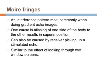 Moire fringes
 An interference pattern most commonly when
doing gradient echo images.
 One cause is aliasing of one side of the body to
the other results in superimposition.
 Can also be caused by receiver picking up a
stimulated echo.
 Similar to the effect of looking through two
window screens.
 