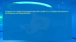 It appears as a region of increased noise with a width of 1 or 2 pixels that extends in
the frequency encoding Direction .
 