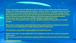 Figure . Schematics show the MR signal effects of flow compensation with gradient moment
nulling. Top: Typical readout gradient waveform. Bottom: Phase of cumulative stationary spins
(solid line) and constant-velocity spins (dotted and dashed lines). (a) During imaging without
flow compensation, the moving spins are not refocused at the desired echo time (TE), and this
leads to the loss of signal from flowing spins. (b) During imaging with gradient moment
nulling, all the spins are refocused, and flow velocity is compensated for by
the 1:2:1 ratio of the gradient lobe areas. GGMR gradient moment nulling gradient, GR readout
gradient.
With motion compensation, the flowing spins with constant velocity (irrespective of what the
velocity is) are brought back into phase, with no effect on static spins.
The penalty for using motion compensation is increased echo time.
Higher order motion compensation also can be obtained for spins with constant acceleration
and for spins
with varying acceleration (wobbling) by applying additional gradient pulses, but this increases
the
echo time even further .
 