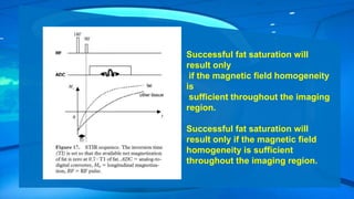 Successful fat saturation will
result only
if the magnetic field homogeneity
is
sufficient throughout the imaging
region.
Successful fat saturation will
result only if the magnetic field
homogeneity is sufficient
throughout the imaging region.
 