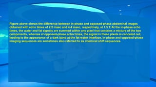 Figure above shows the difference between in-phase and opposed-phase abdominal images
obtained with echo times of 2.2 msec and 4.4 msec, respectively, at 1.5 T. At the in-phase echo
times, the water and fat signals are summed within any pixel that contains a mixture of the two
components, whereas at opposed-phase echo times, the signal in these pixels is canceled out,
leading to the appearance of a dark band at the fat-water interface. In-phase and opposed-phase
imaging sequences are sometimes also referred to as chemical shift sequences.
 