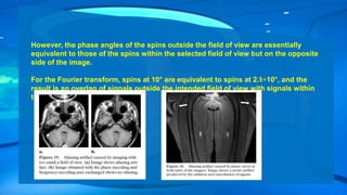 However, the phase angles of the spins outside the field of view are essentially
equivalent to those of the spins within the selected field of view but on the opposite
side of the image.
For the Fourier transform, spins at 10° are equivalent to spins at 2Л+10°, and the
result is an overlap of signals outside the intended field of view with signals within
that field of view.
 