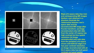 Maps of k-space data (top row)
and corresponding MR images
(bottom row) obtained in a
phantom illustrate the
relationship between raw k-
space data and the
reconstructed MR image after
Fourier transform. (a) Image
reconstructed only with data
from the center of k-space has
high contrast but low spatial
resolution (b) Image
reconstructed only with data
from the periphery of k-space
shows well-defined edges but
has poor contrast resolution.
(c) Image reconstructed with all
the k-space data has both good
contrast and good spatial
 