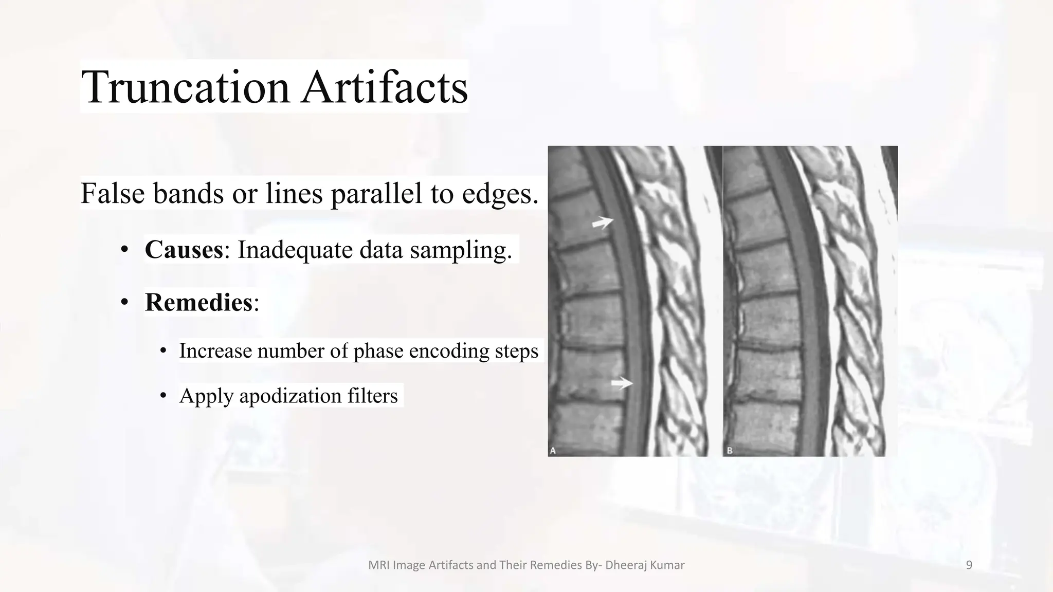 MRI Artifacts and Their Remedies/Corrections.pptx